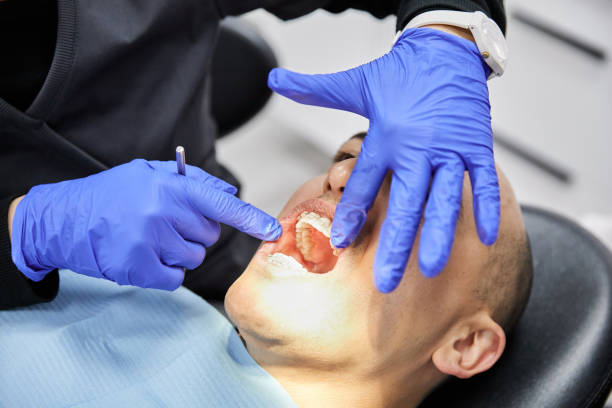 Best Emergency Dentist for Lost Fillings or Crowns in St James City, FL